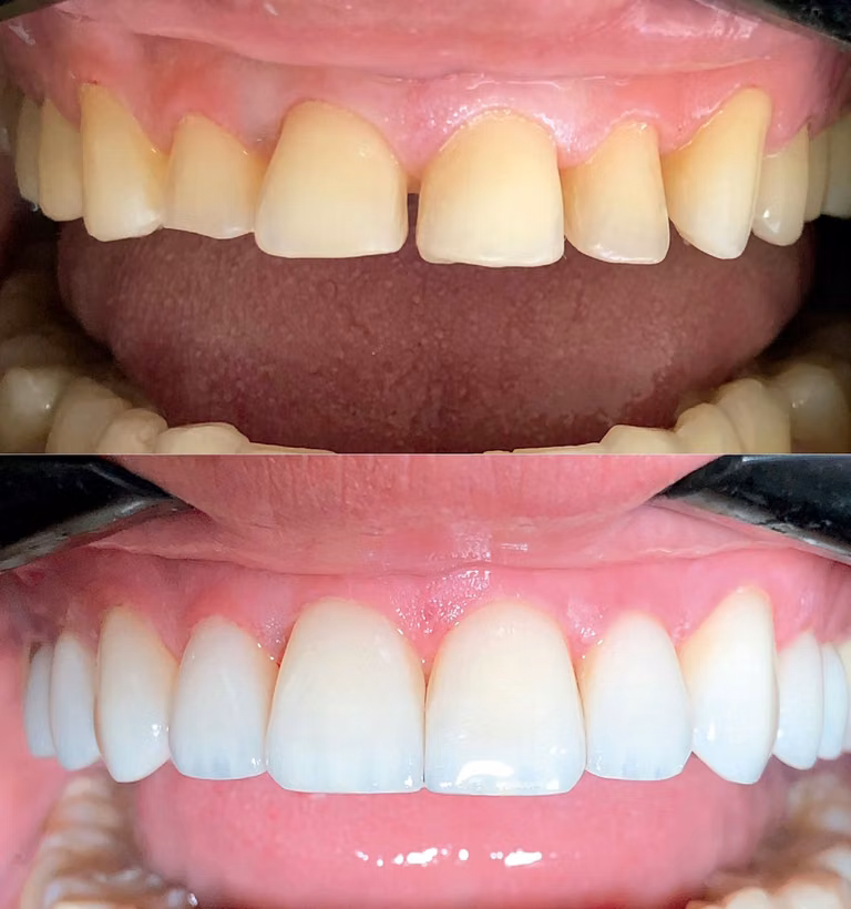Reabilitação oral estética – foto 1