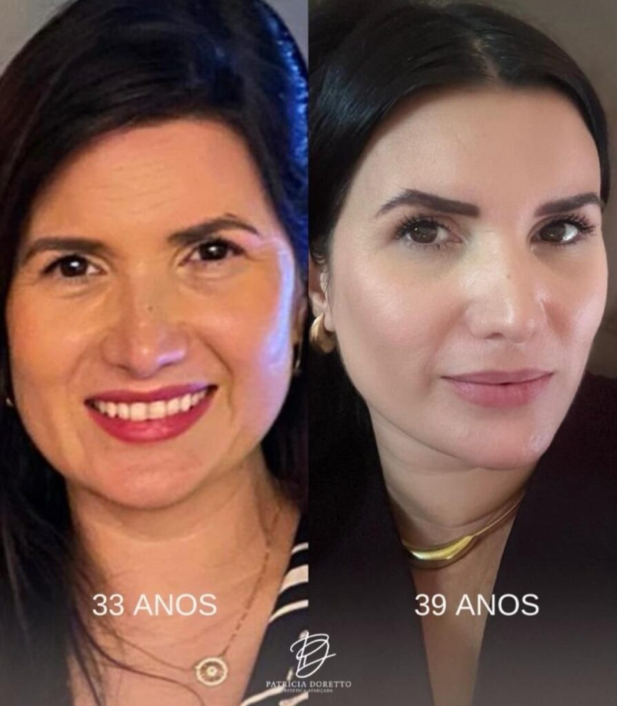 Regenerar: A Arte de Rejuvenescer Respeitando a Biologia da Pele